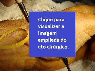 Foto: Ortoclínica Manus. Clique para ampliar.